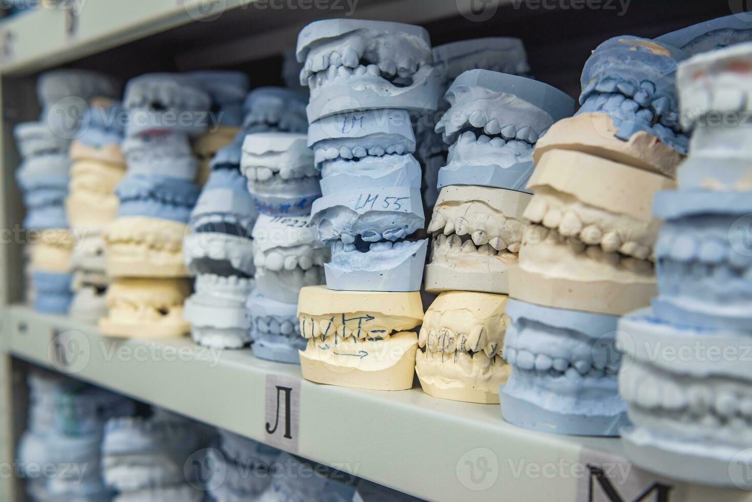 almacén de yeso modelos de humano mandíbulas en un ortodoncia clínica. controlar y diagnóstico dental yesos para alineadores. foto