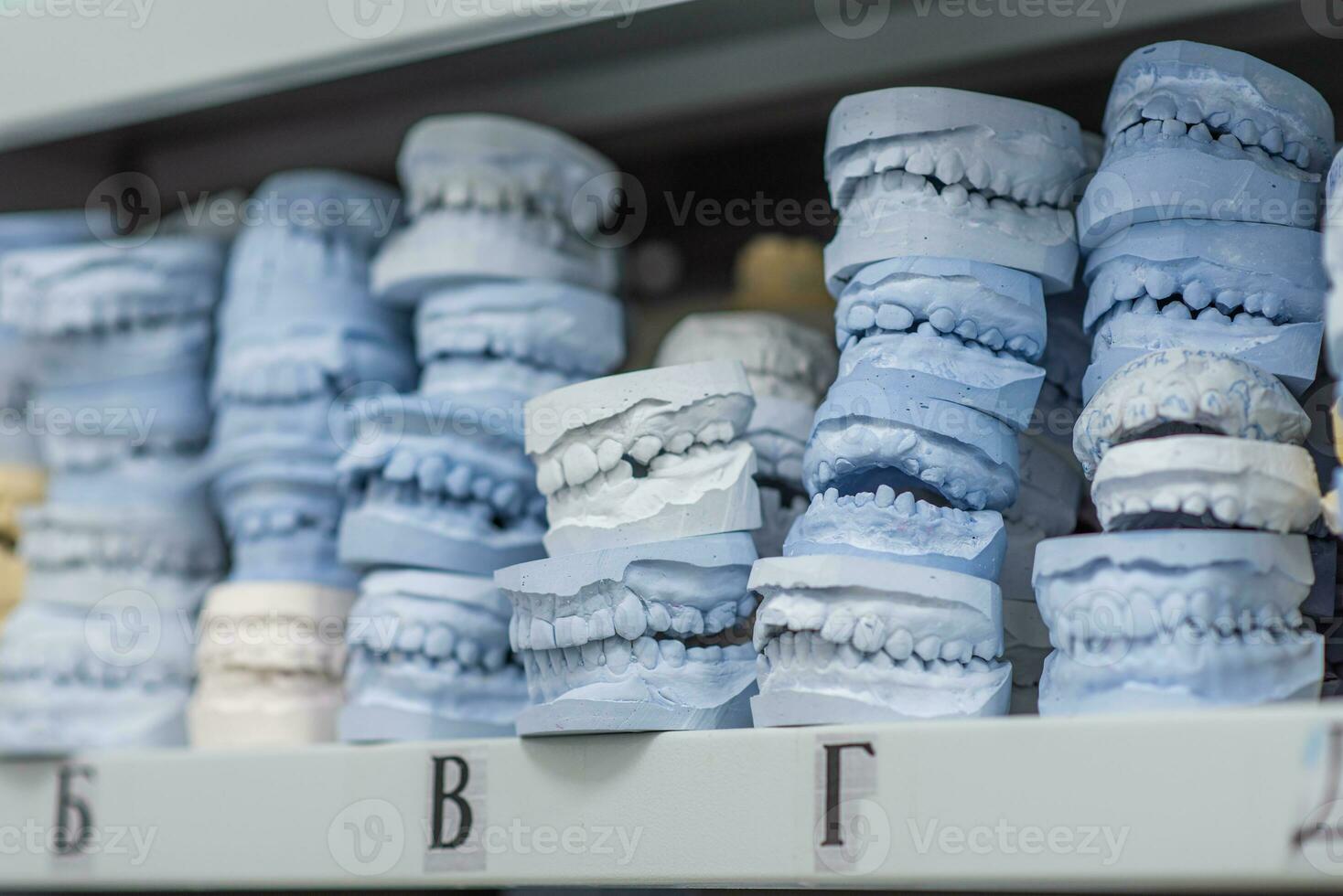 almacén de yeso modelos de humano mandíbulas en un ortodoncia clínica. controlar y diagnóstico dental yesos para alineadores. foto