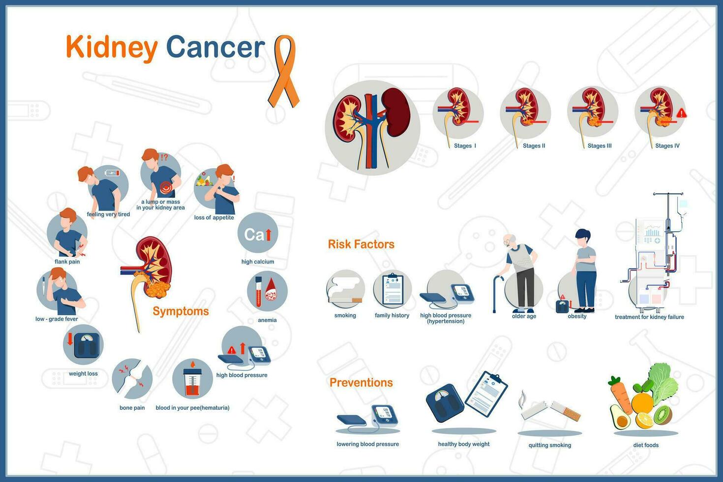 Flat medical vector illustration infographic, kidney cancer concept.states of kidney cancer, symptoms, causes and risk factors. Prevention of kidney cancer.isolated on white background.