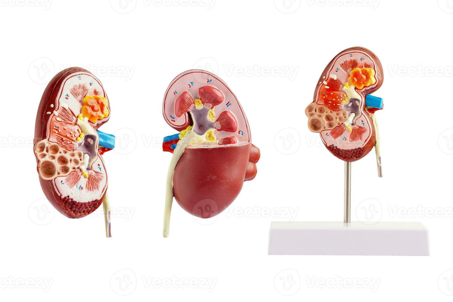 riñón modelo aislado en blanco antecedentes crónico riñón enfermedad, tratamiento urinario sistema, urología, estimado glomerular filtración Velocidad egfr. foto