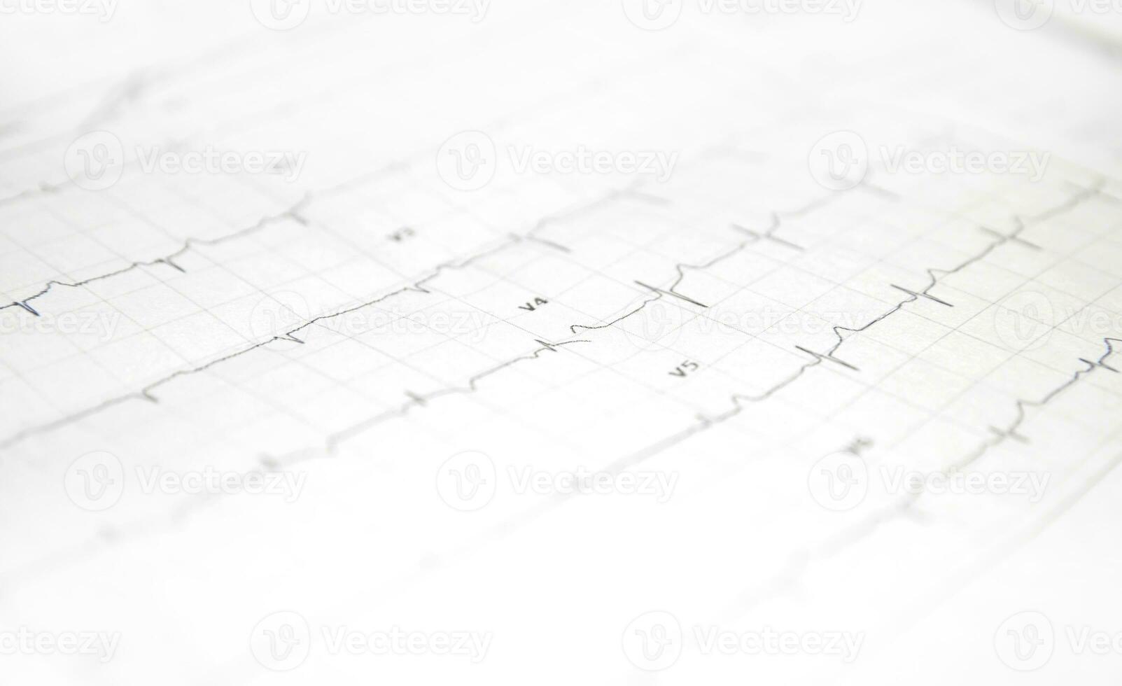 un tarjeta con un cardiograma de el corazón. alto calidad foto