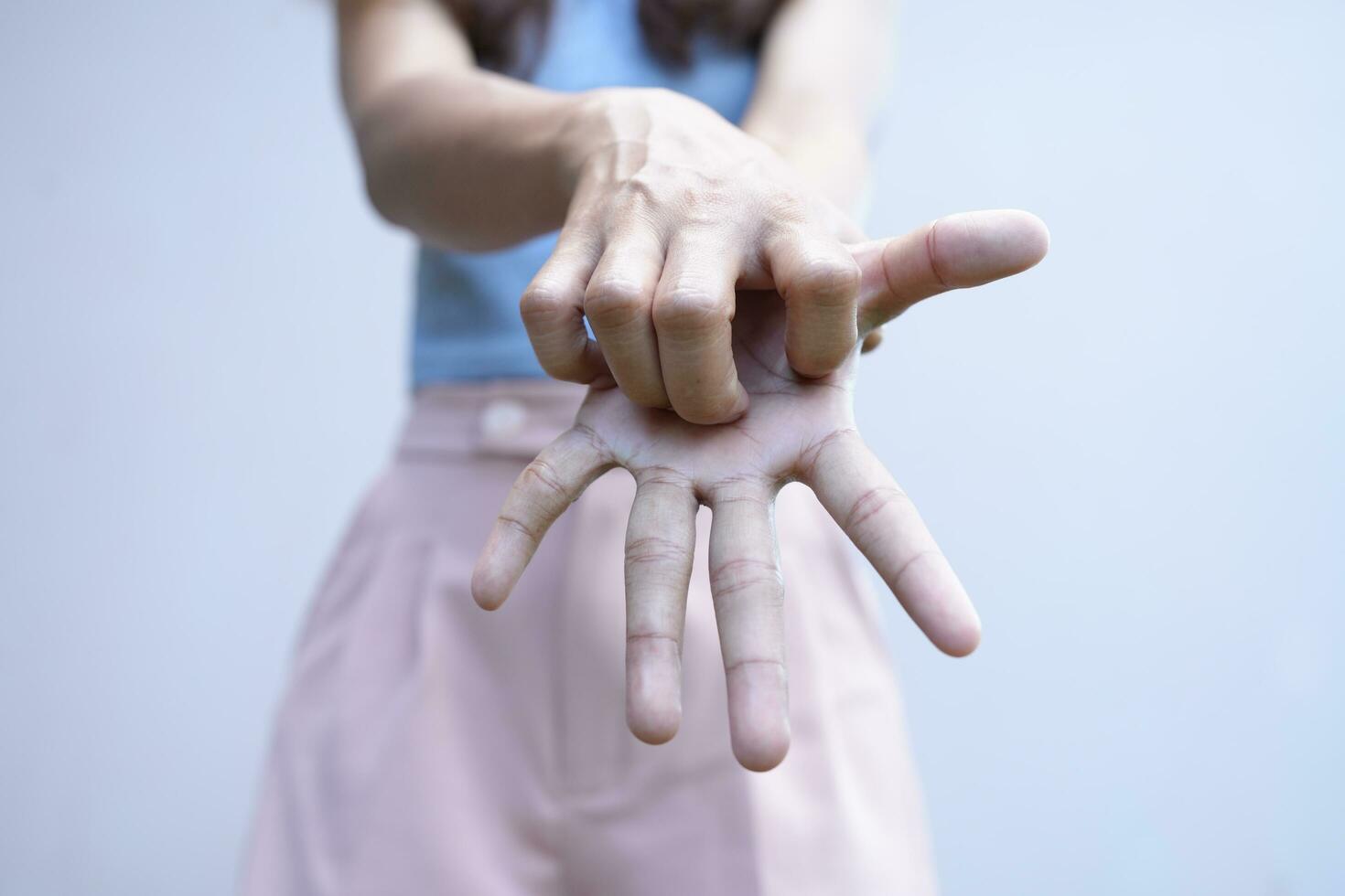 Asian woman has itching on her hand photo