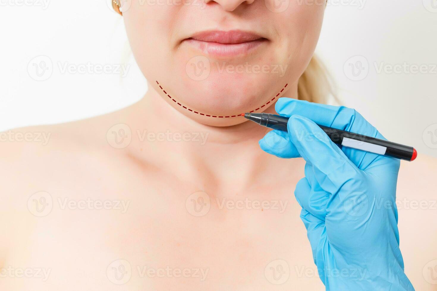 Chin reduction augmentation double chin removal plastic surgery cosmetic operation concept Woman eyes closed waiting doctor surgeon hands to draw the cut line the double chin isolated white background photo