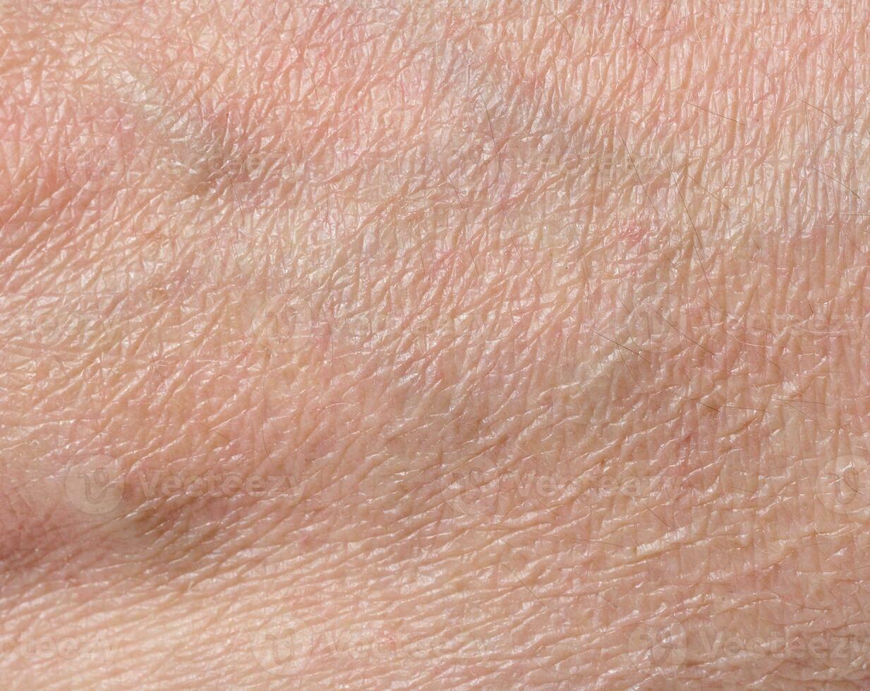 White person skin texture photo