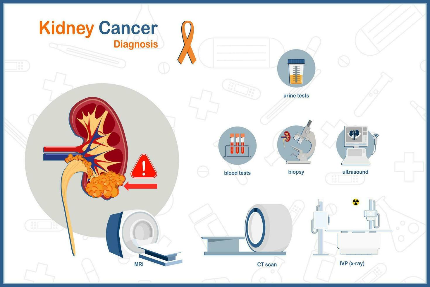 Medical vector illustration concept in flat style of kidney cancer treatment. Urine test, blood test, ultrasound, biopsy, MRI, CT scan.isolated on white background.
