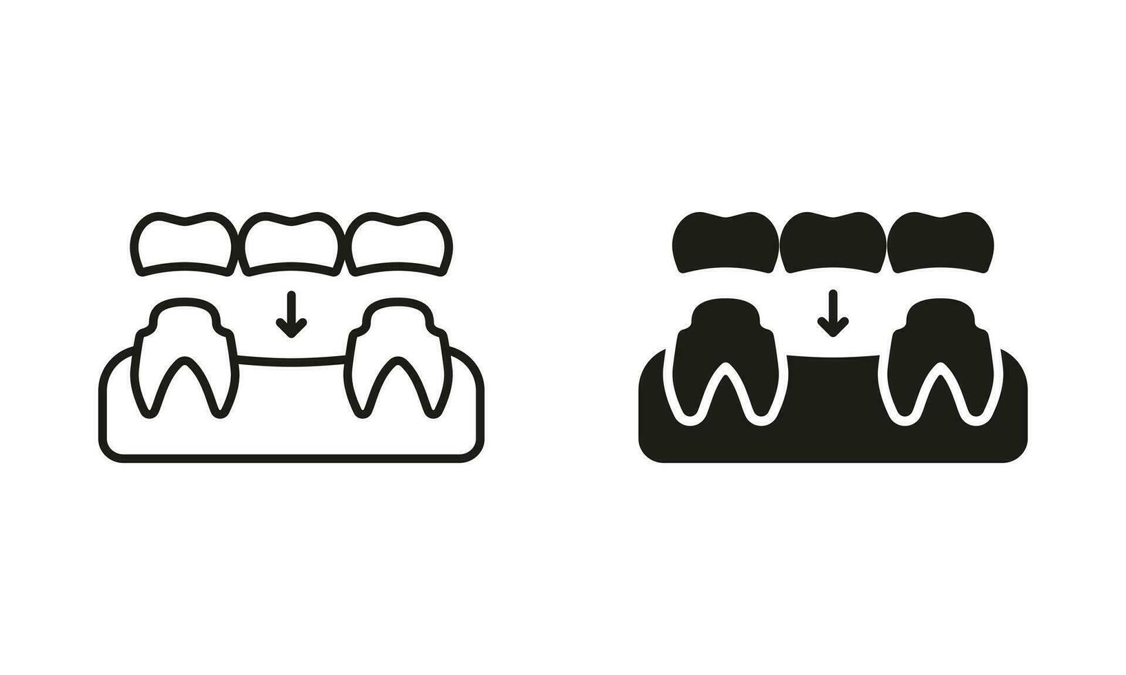 Dental Bridge Silhouette and Line Icon Set. Tooth Regeneration. Porcelain Denture Pictogram. Partial Teeth Implant Restoration. Dental Treatment Black Symbol Collection. Isolated Vector Illustration.