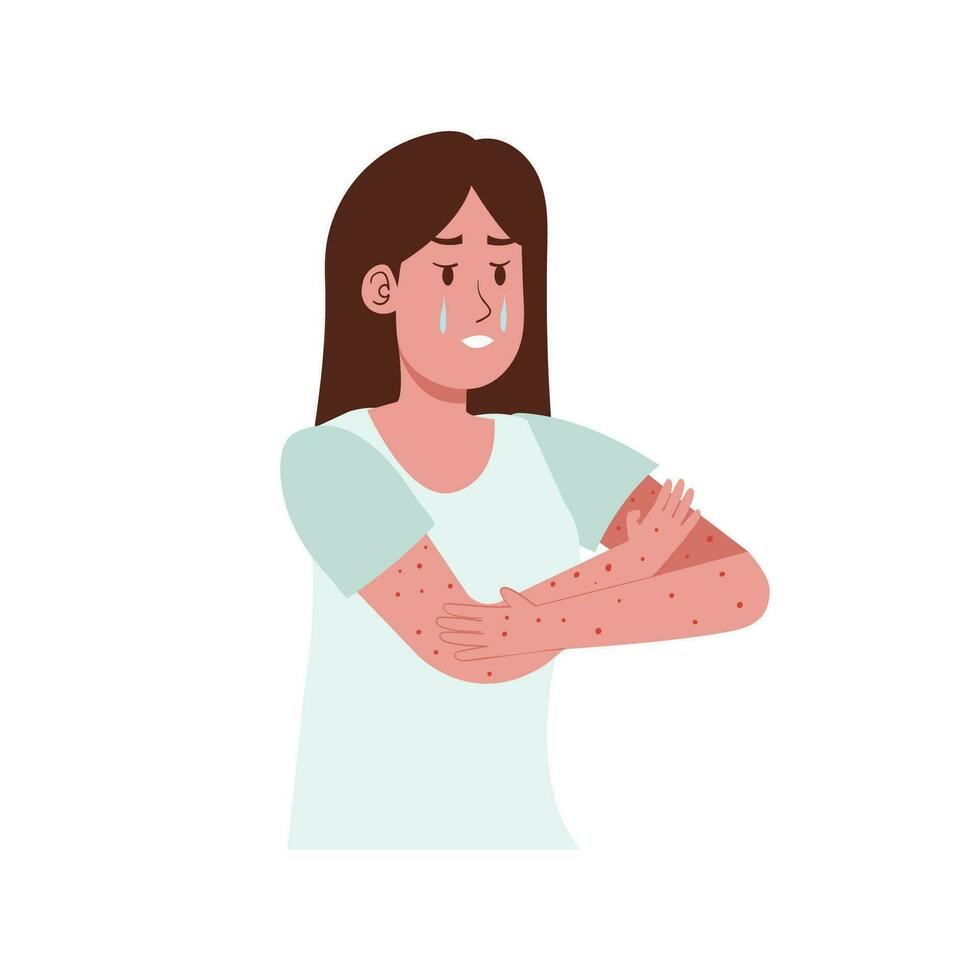 Comezón a mano o irritación eczema debido a alergia sensible piel problema ilustración vector