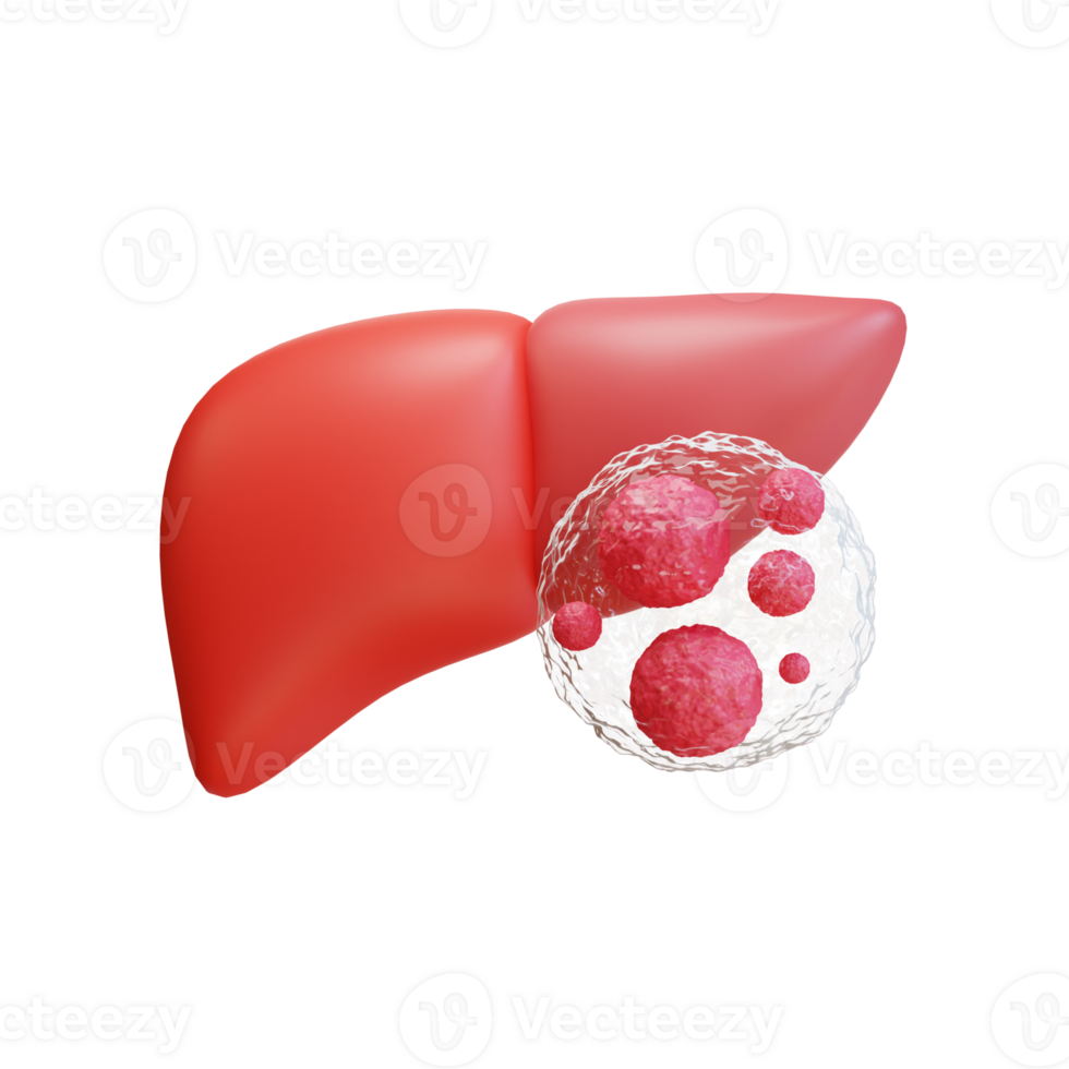 hígado cáncer hepatoma , hepatocelular carcinoma, causas y tratamiento. 3d ilustración icono png