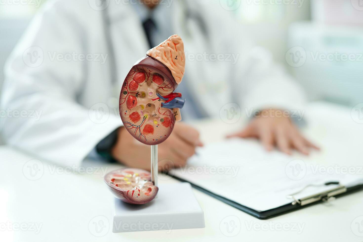 Chronic kidney disease, doctor with model for treatment urinary system, urology, Estimated glomerular filtration rate eGFR. photo