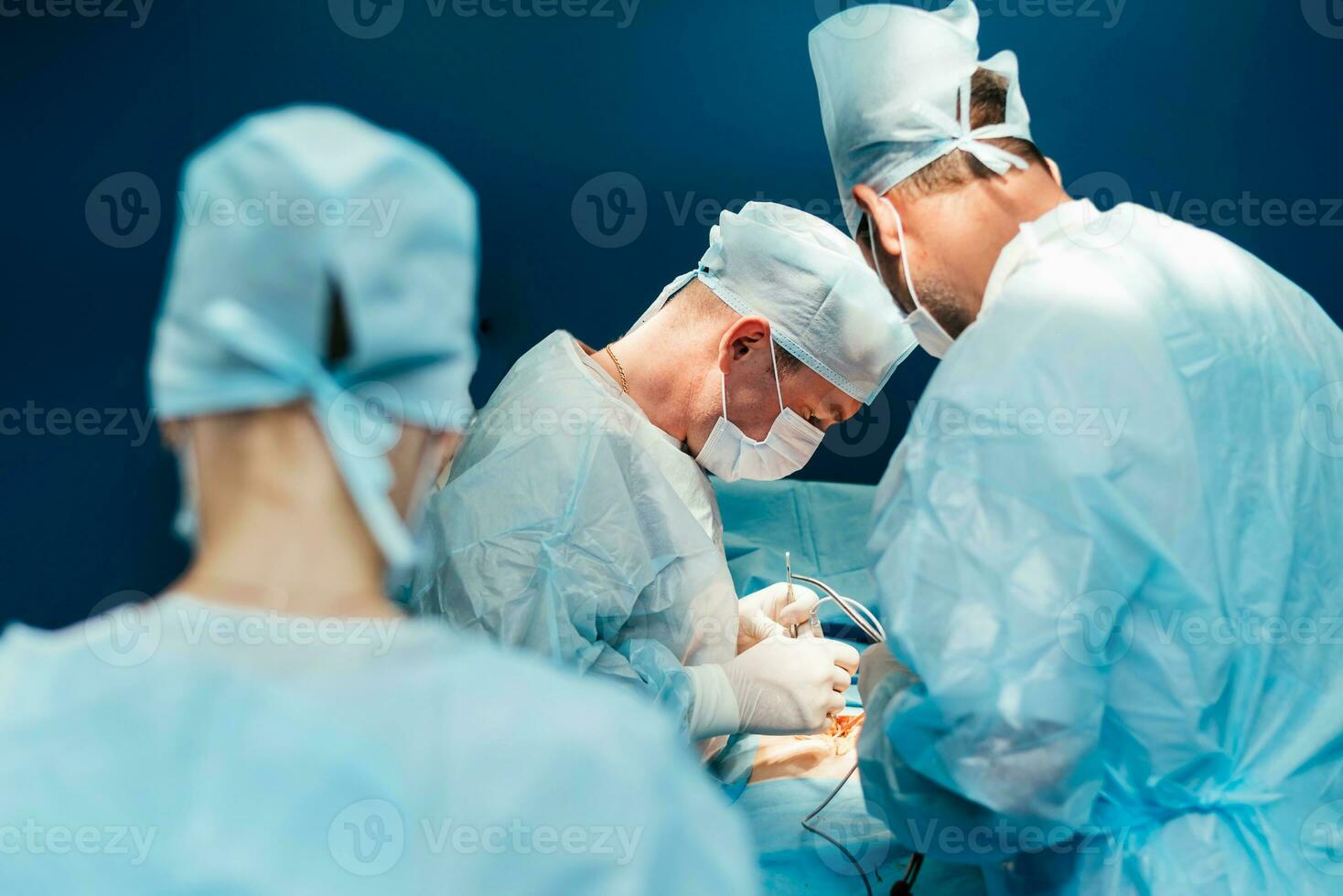 A highly qualified team of surgeons performs a complex operation to remove a pancreatic cyst using medical instruments photo