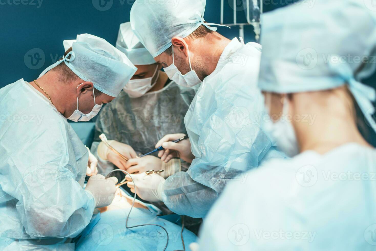 A highly qualified team of surgeons performs a complex operation to remove a pancreatic cyst using medical instruments photo