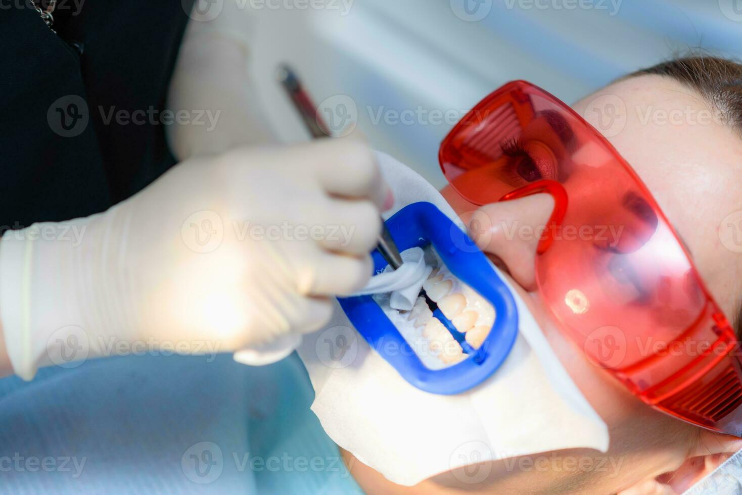 preparando el oral cavidad para blanqueo con un ultravioleta lámpara. de cerca foto