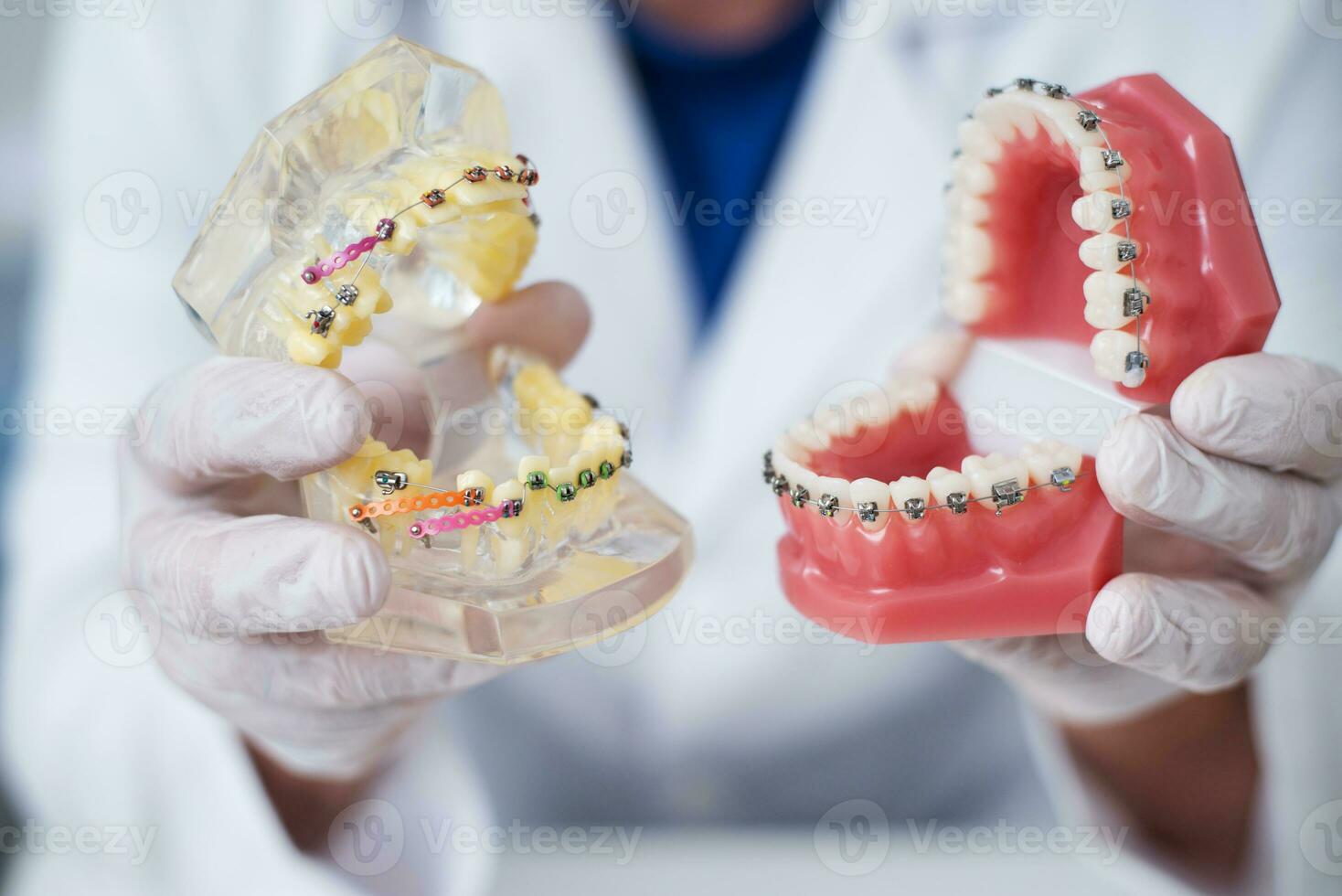 doctor orthodontist shows how the system of braces on teeth is arranged photo