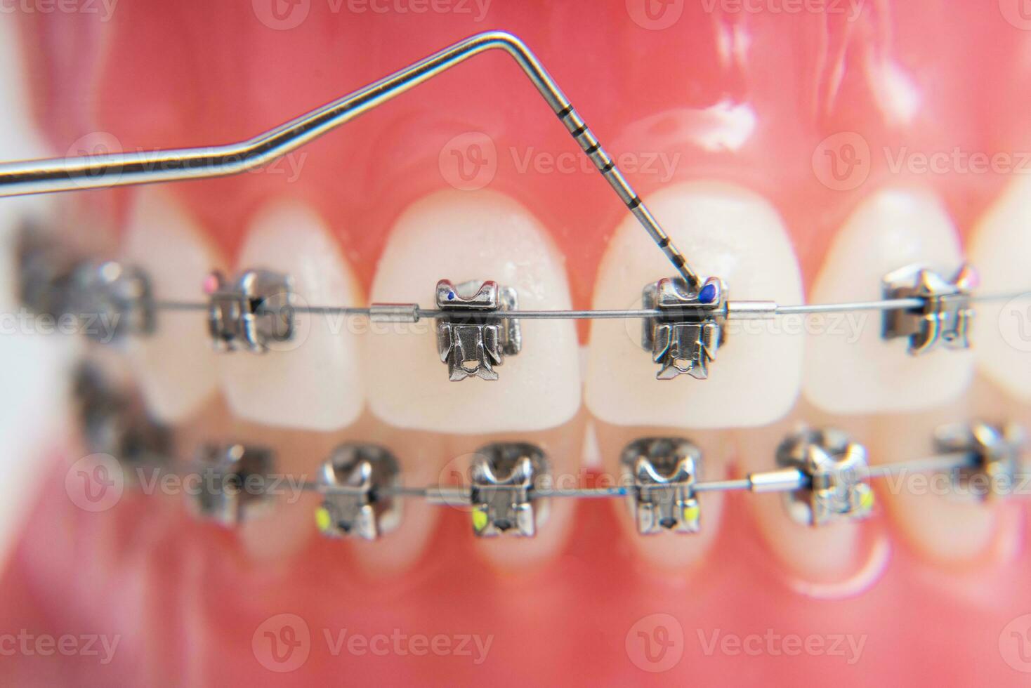 on macro photos shows how the system of brackets is arranged