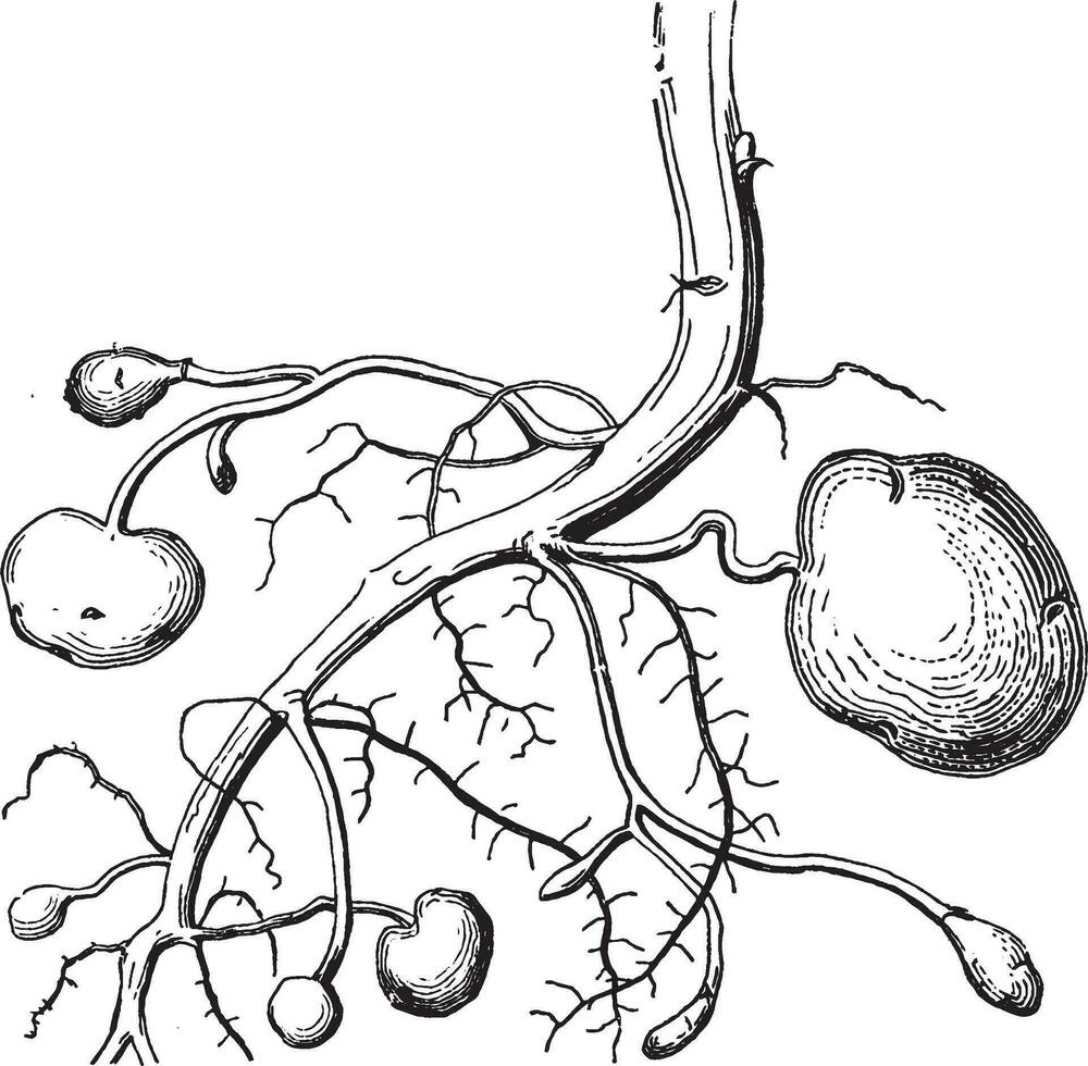 Potato Root vintage illustration. vector