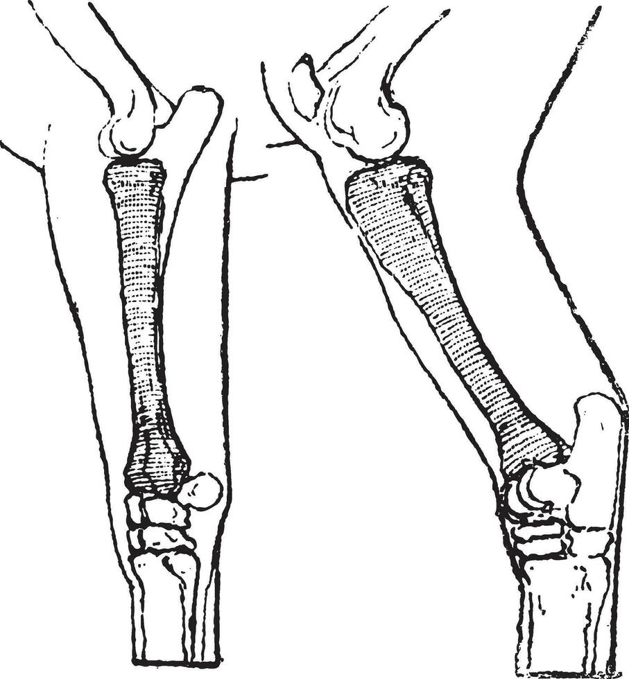 Radius and Tibia of a Horse, vintage engraving vector