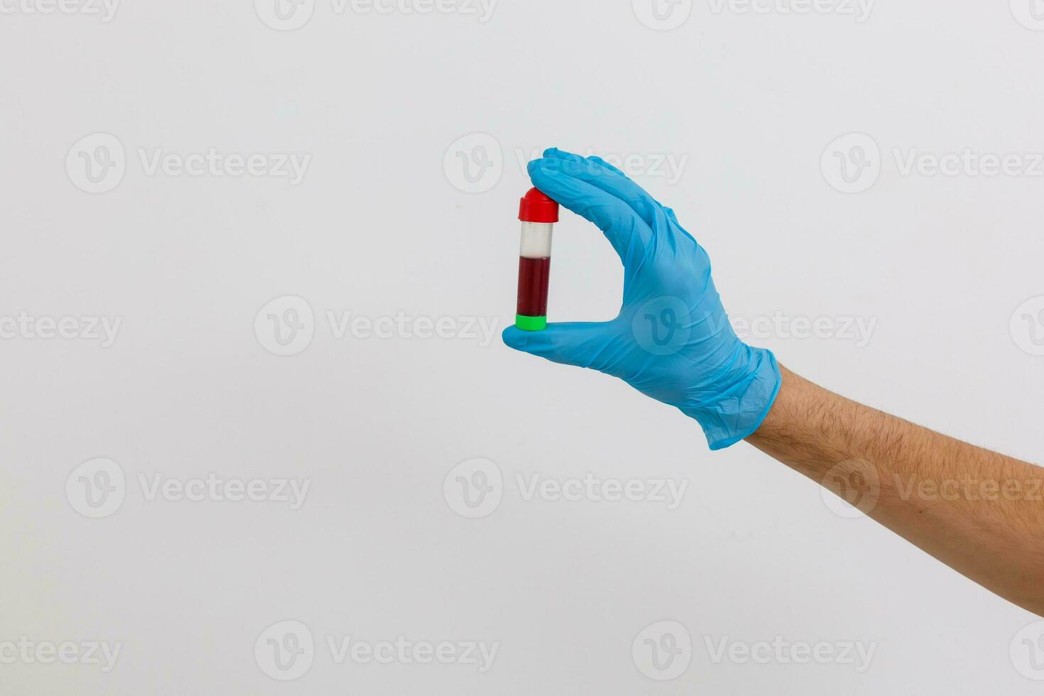 hand holding blood in test tube close up photo