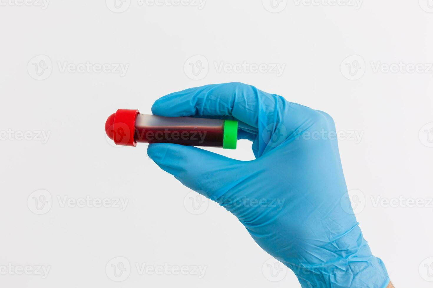 hand holding blood in test tube close up photo