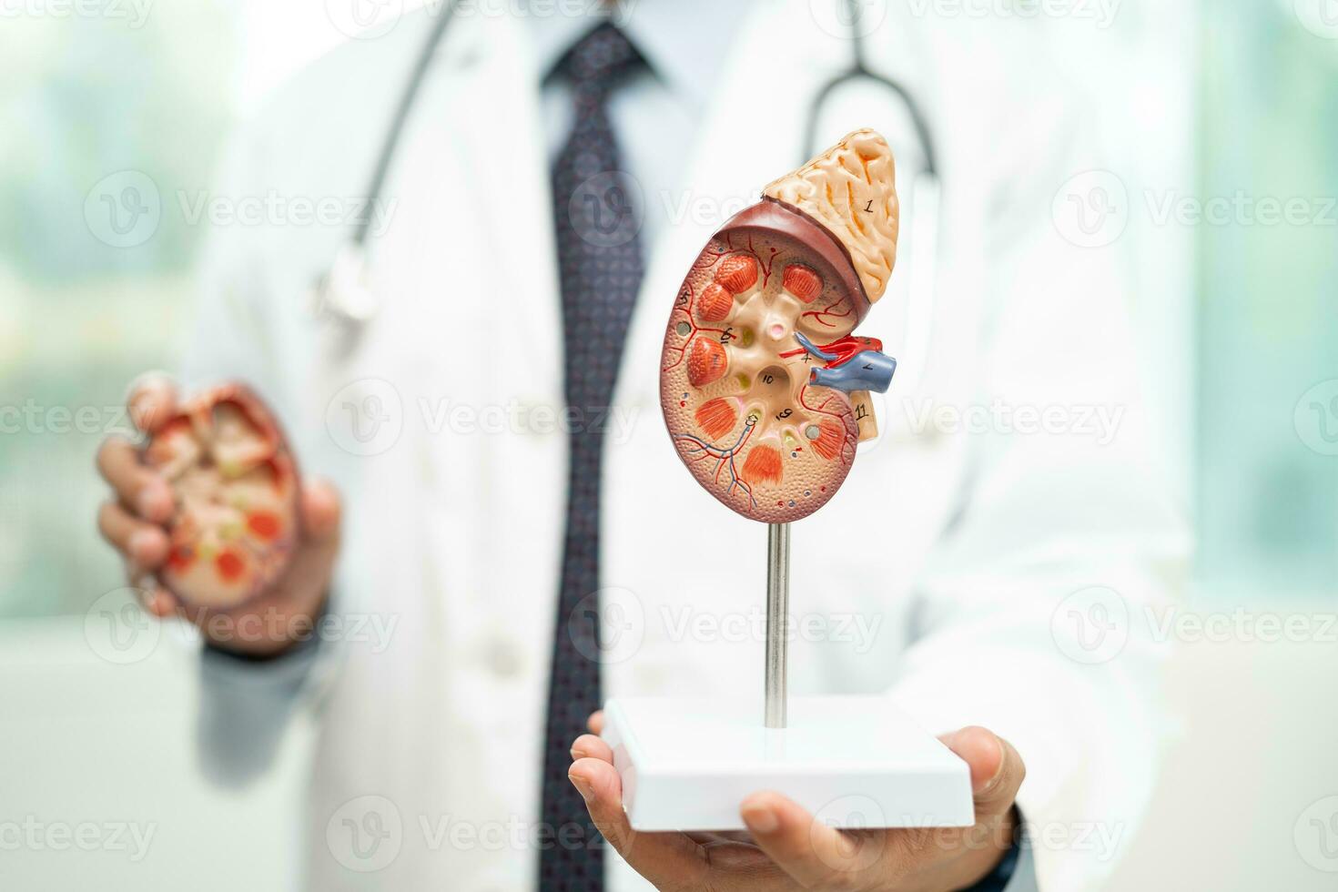 Kidney disease, Chronic kidney disease ckd, Doctor with human model to study and treat in hospital. photo