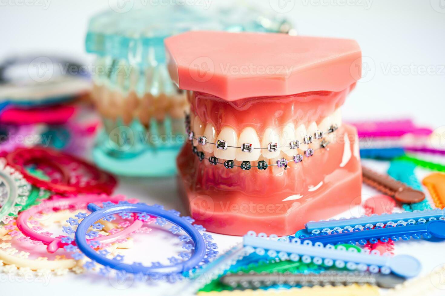 Orthodontic ligatures rings and ties, elastic rubber bands on orthodontic  braces, model for dentist studying about dentistry. 33303149 Stock Photo at  Vecteezy