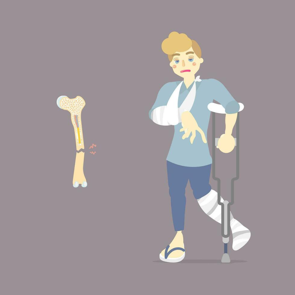 sad patient with cast on broken leg and arm bone holding crutch, walking aid, internal organs body part orthopedic health care, fracture concept, flat vector illustration character cartoon design