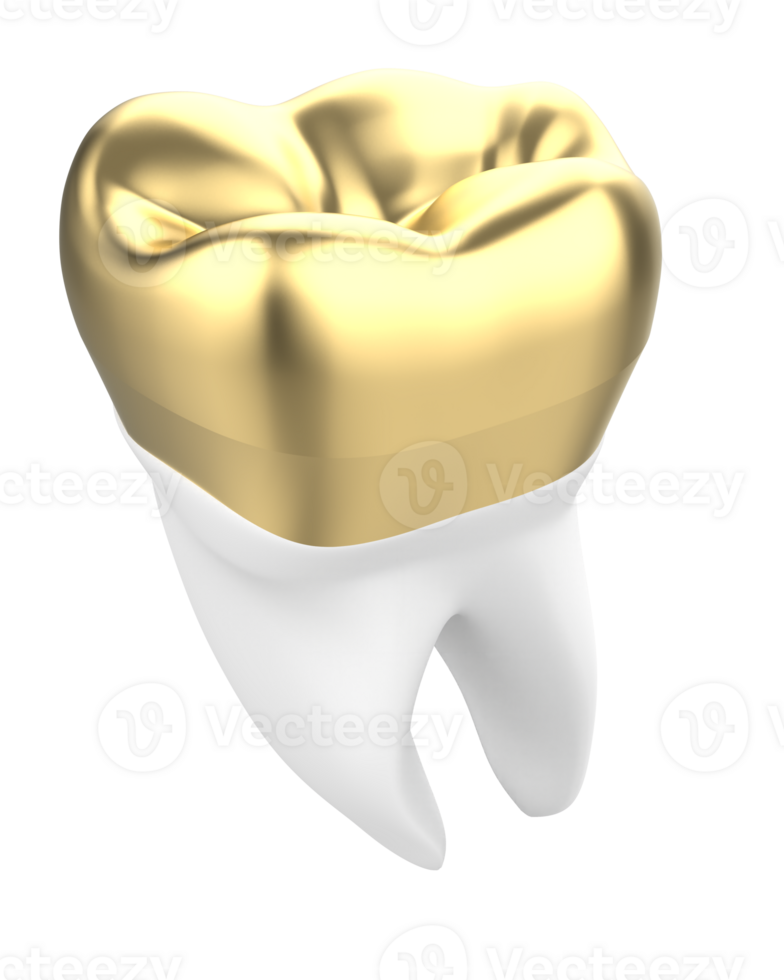 Tooth implant isolated on background. 3d rendering- illustration png