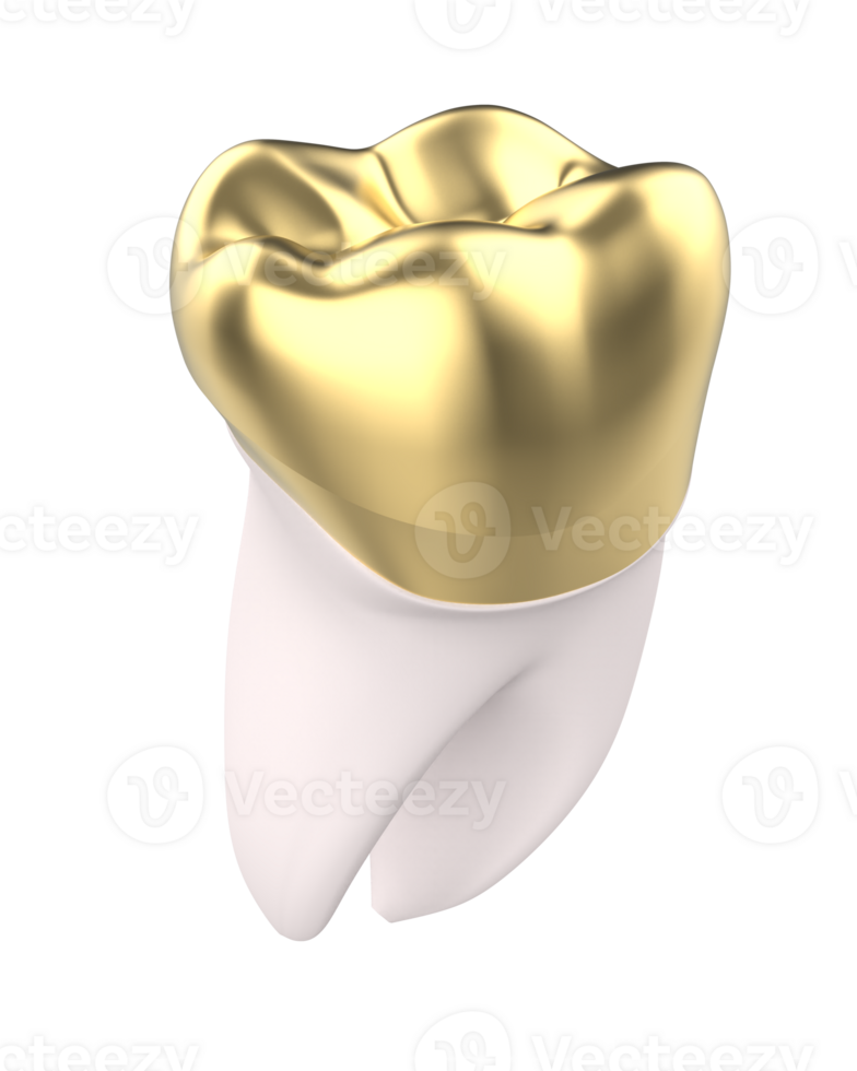 Tooth implant isolated on background. 3d rendering- illustration png
