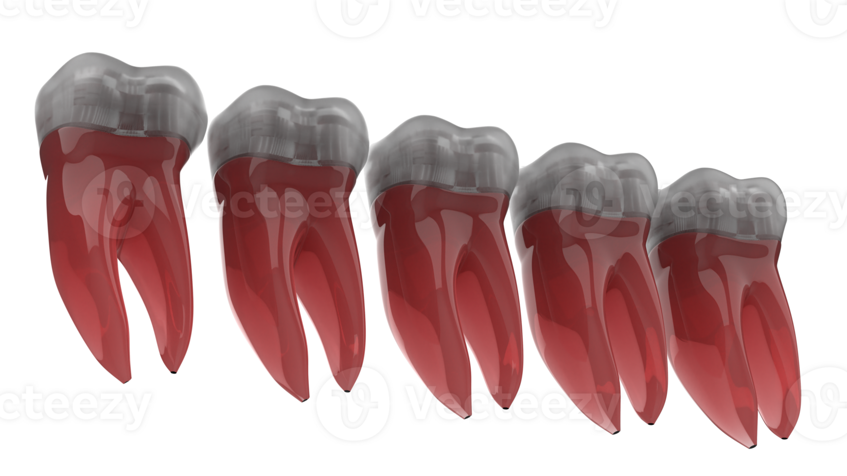 Tooth implant isolated on background. 3d rendering- illustration png