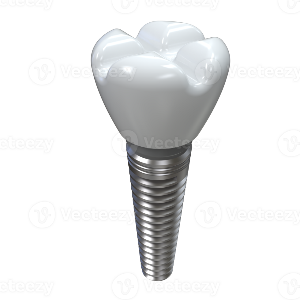 Tooth implant isolated on background. 3d rendering- illustration png