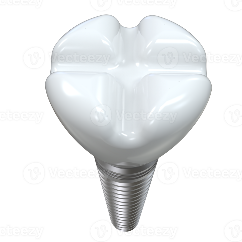 Tooth implant isolated on background. 3d rendering- illustration png