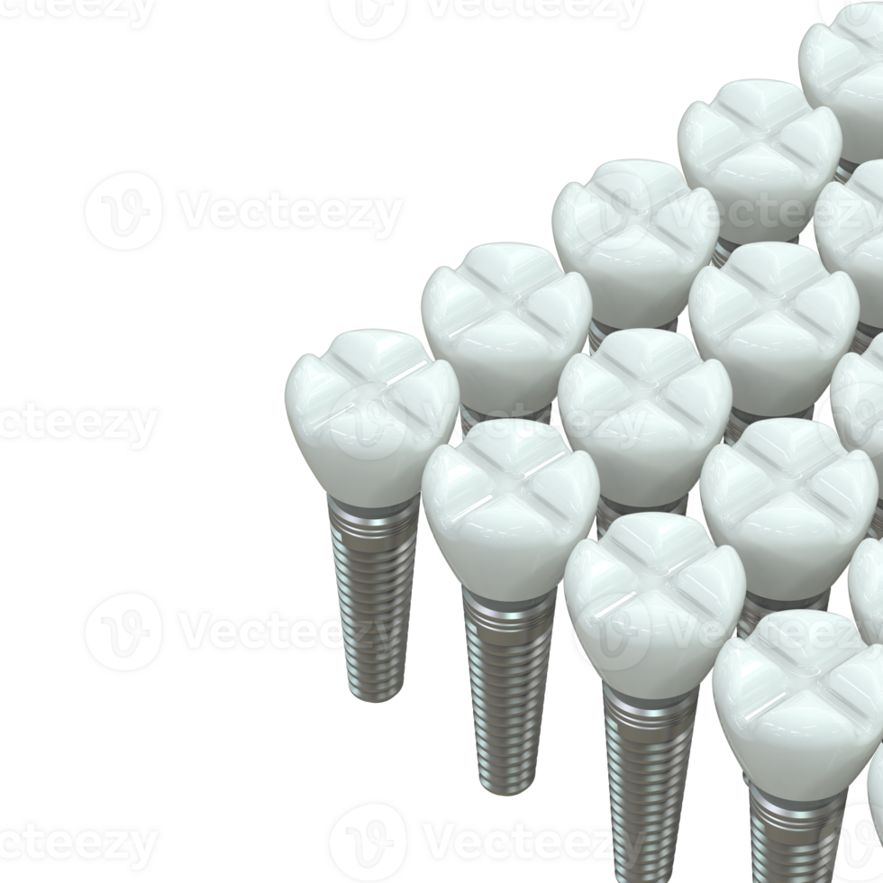 Tooth implant isolated on background. 3d rendering- illustration png