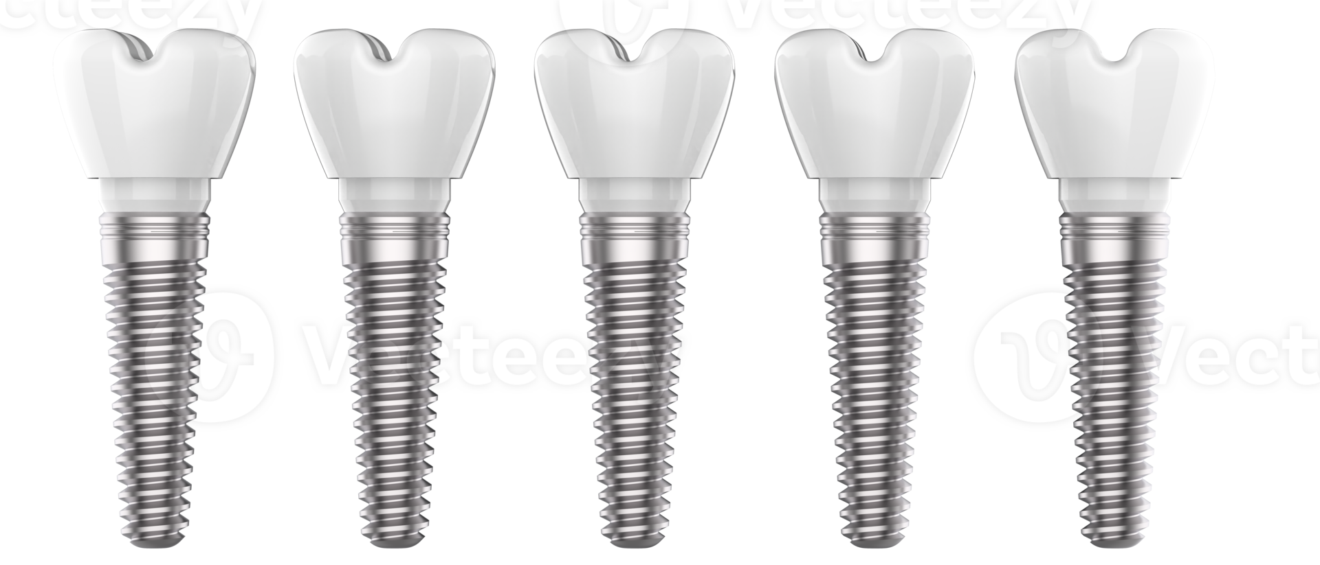 Tooth implant isolated on background. 3d rendering- illustration png