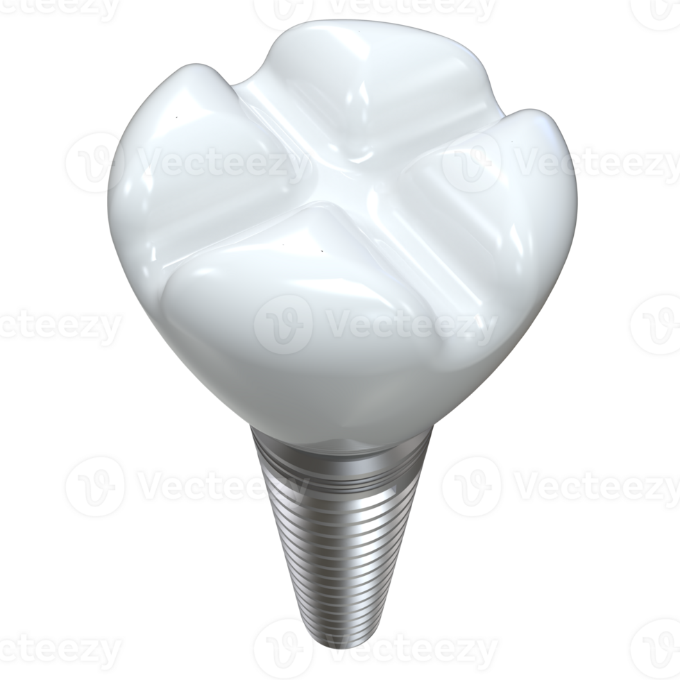 Tooth implant isolated on background. 3d rendering- illustration png