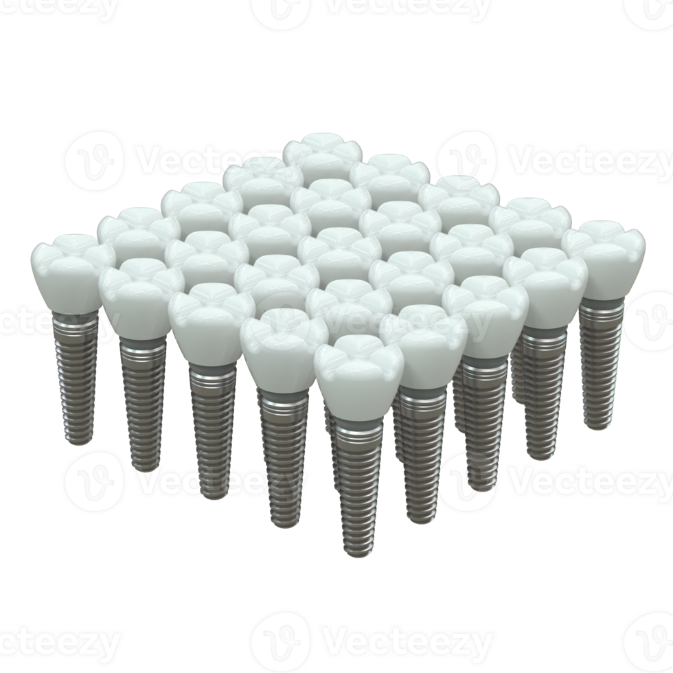 Tooth implant isolated on background. 3d rendering- illustration png