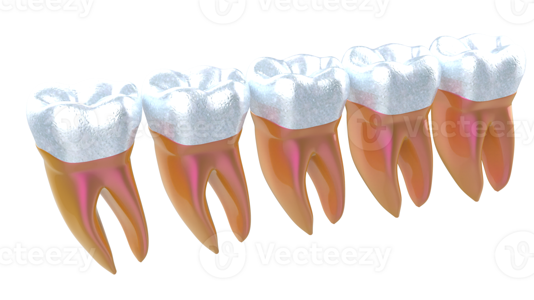 dent implant isolé sur Contexte. 3d le rendu- illustration png