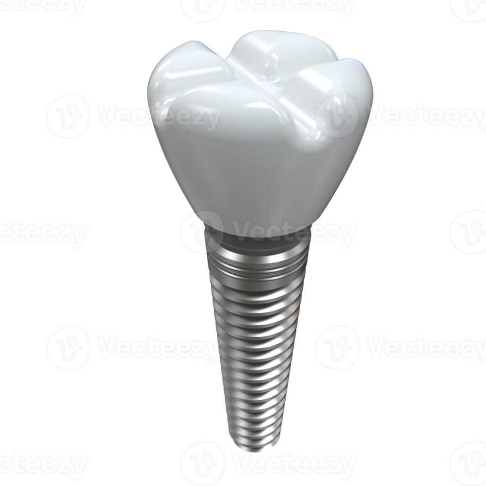 Tooth implant isolated on background. 3d rendering- illustration png