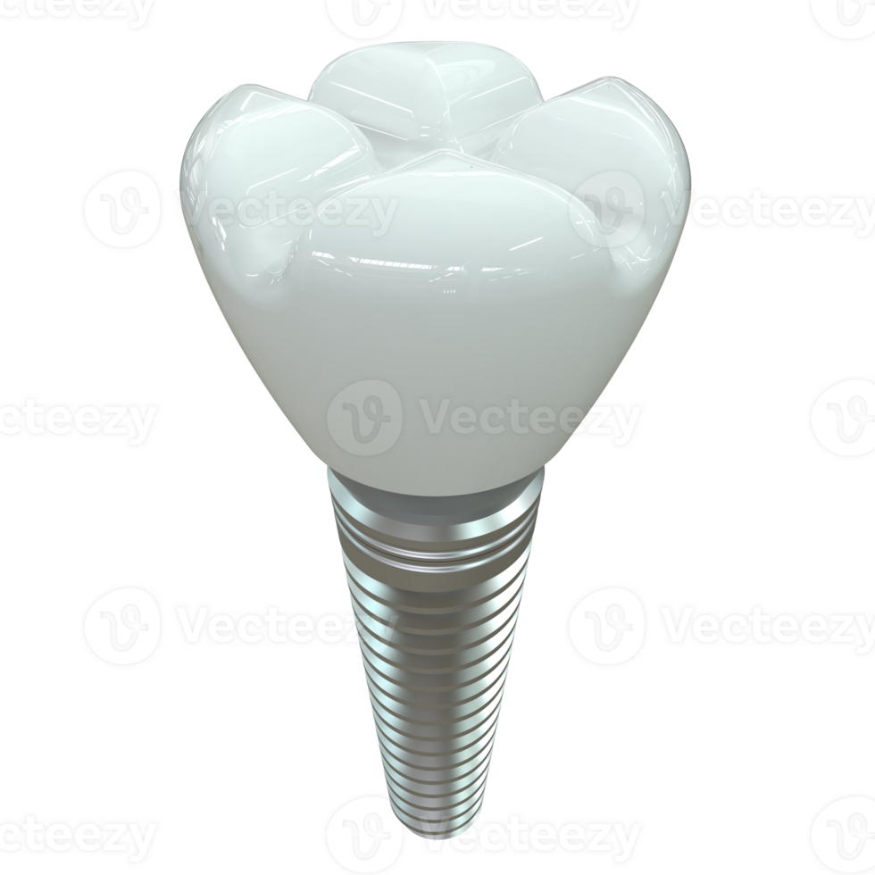 Tooth implant isolated on background. 3d rendering- illustration png