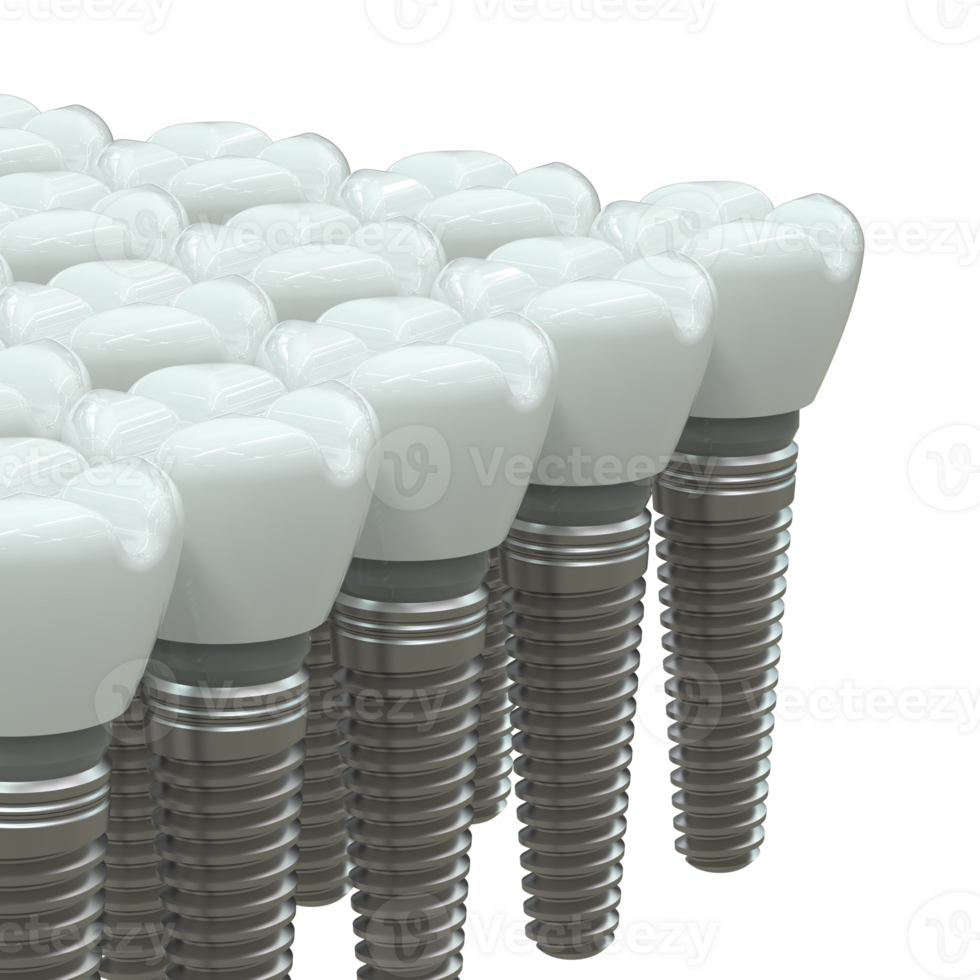 Tooth implant isolated on background. 3d rendering- illustration png