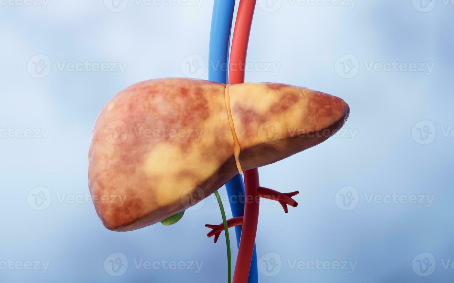 hígado Organo con graso hígado estado, 3d representación. foto