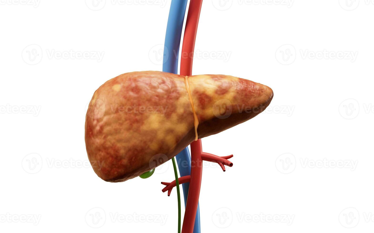 Liver organ with fatty liver state, 3d rendering. photo