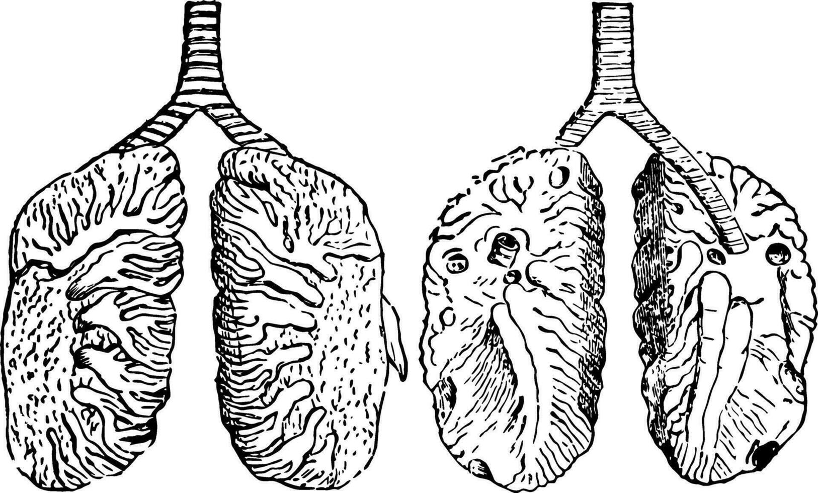 Lungs of a Pigeon, vintage illustration. vector