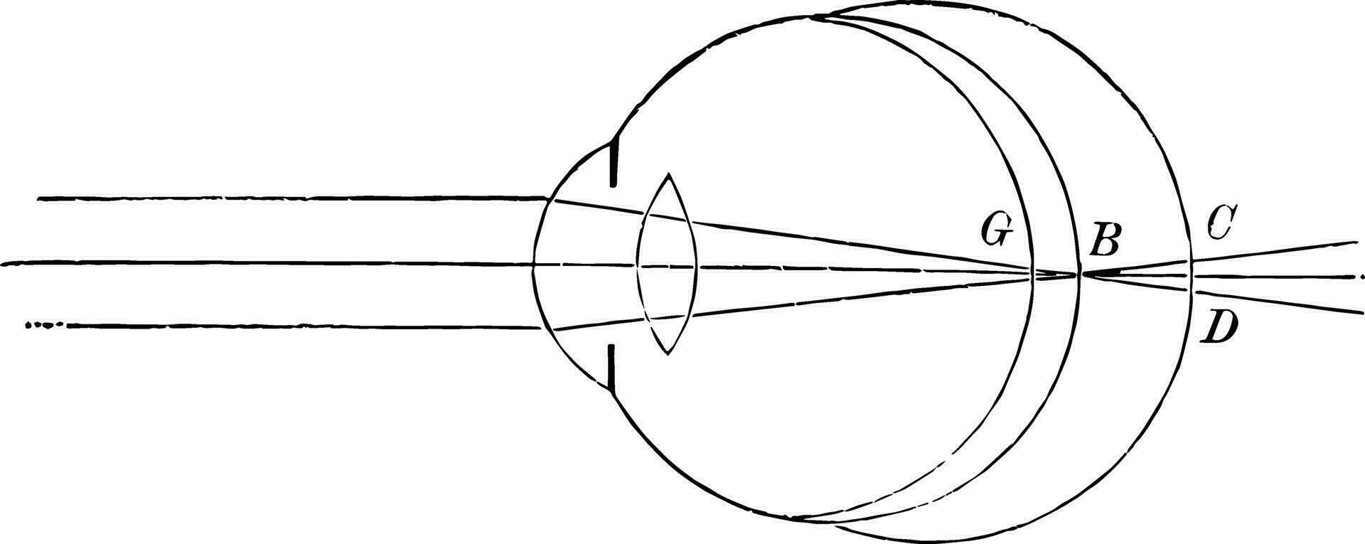 el posición de el retina en cerca y lejos vista, Clásico ilustración. vector