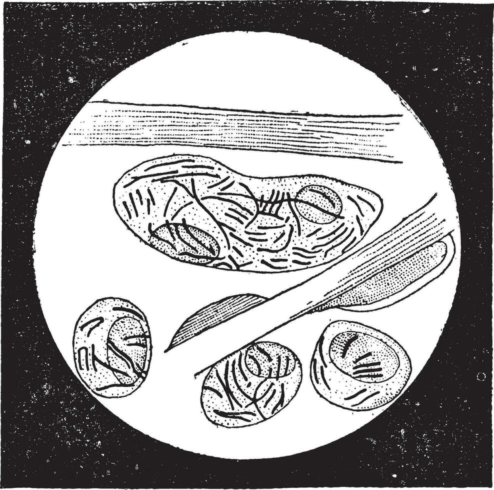 micobacteria lepras, Clásico grabado vector