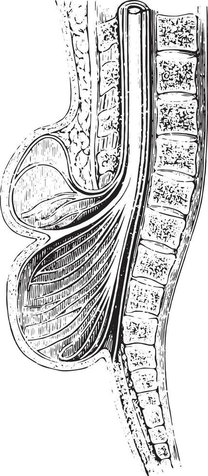 Cup anteroposterior spinal practiced on a spina bifida, vintage vector