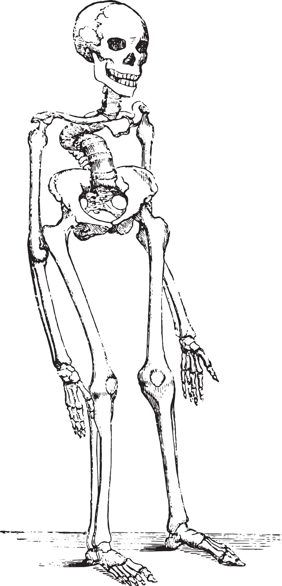 Old Engraved Illustration Of A Female Skeleton Deformed By