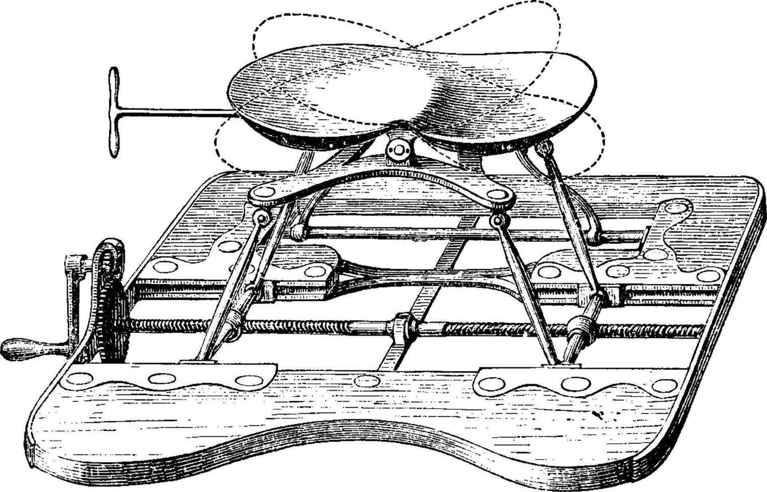 Apparatus for lithotripsy, the seat being high, vintage engravin vector