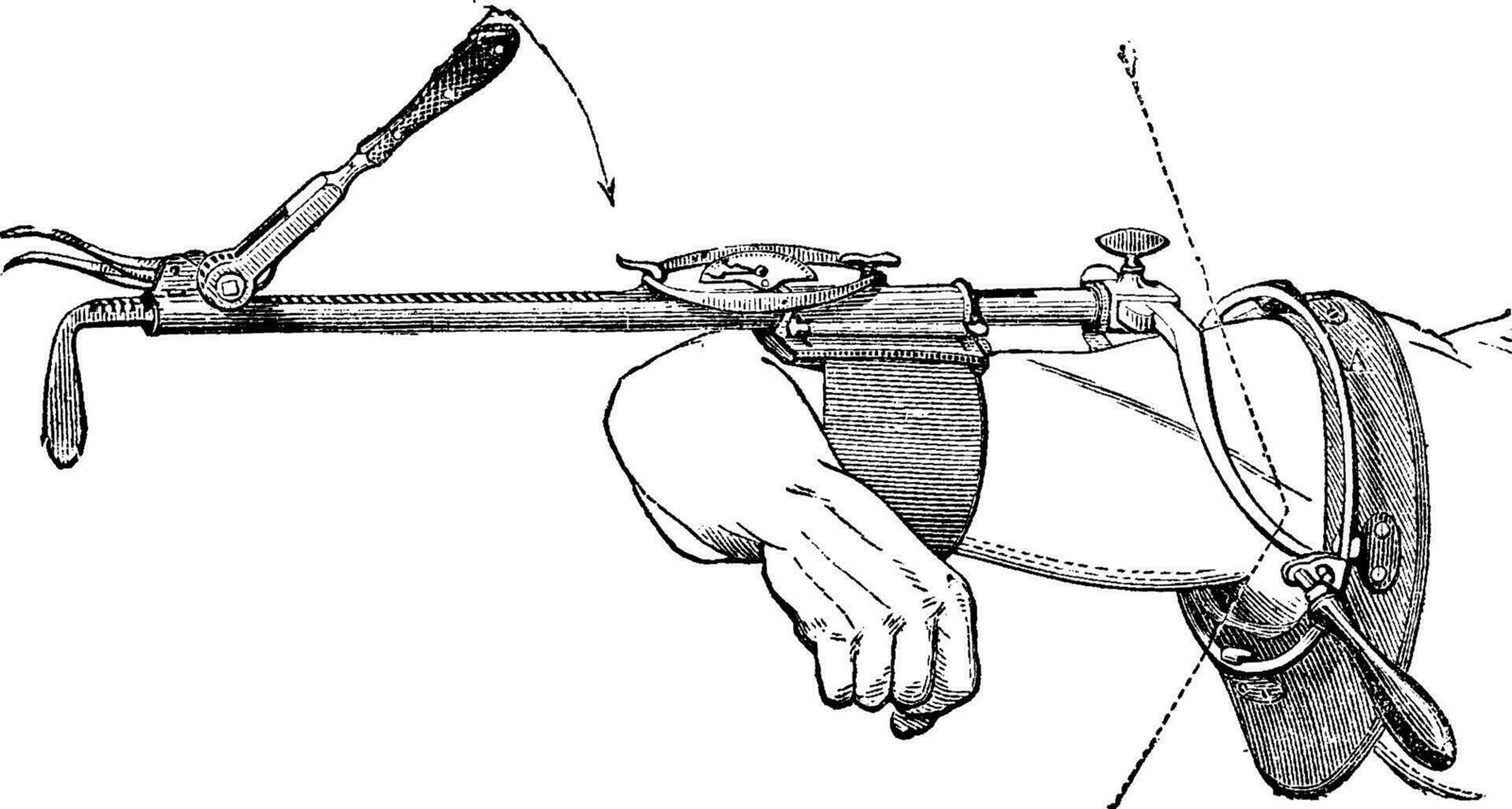 Charriere device, vintage engraving. vector