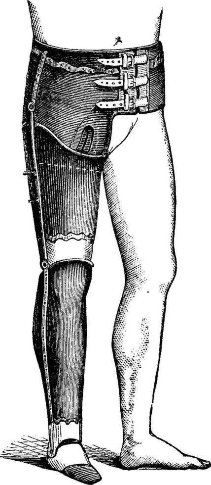 Artificial Leg for Full Hip Disarticulation, vintage engraving vector