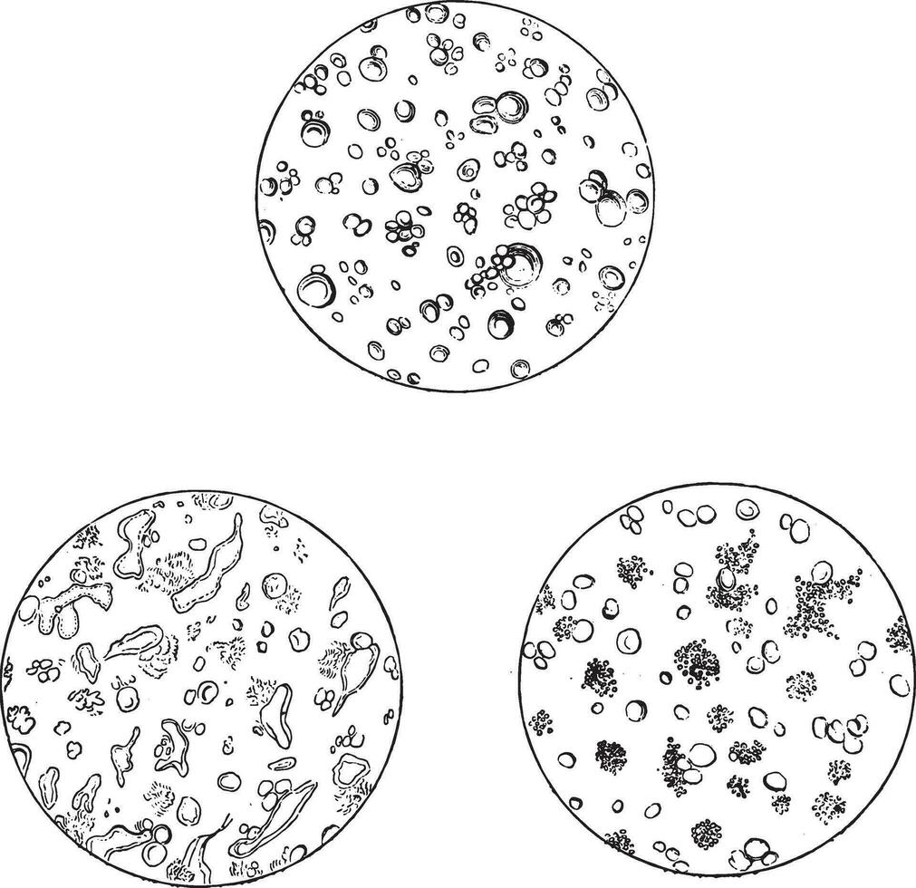 Fig 3 Milk seen under a microscope, Fig 4 Milk factory with calf brains, Fig 5 Milk of a sick cow, vintage engraving. vector