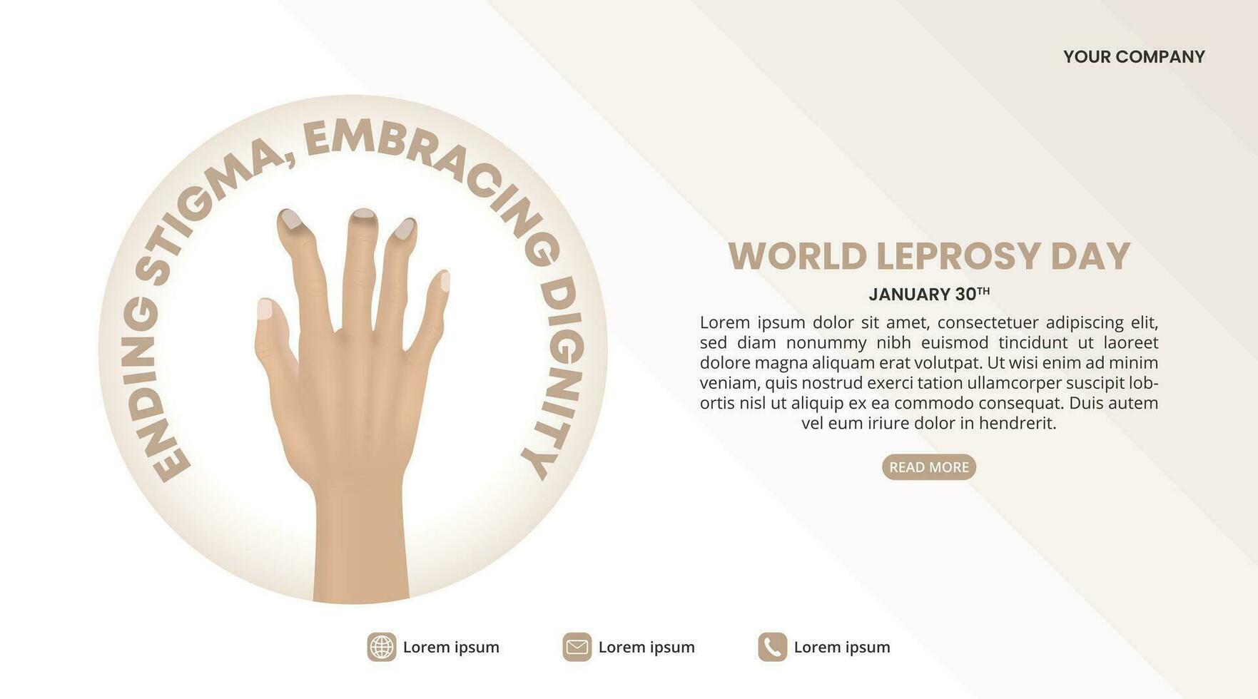 World Leprosy Day background with a claw hand in leprosy vector